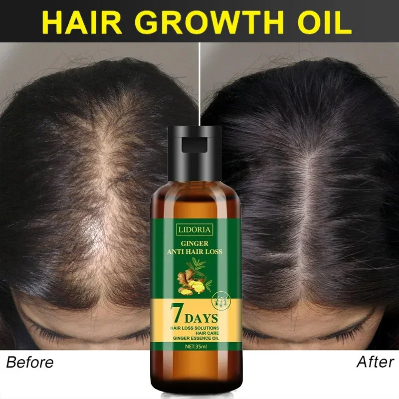 Ginger Hair Growth Serum – Anti-Hair Loss & Regrowth
