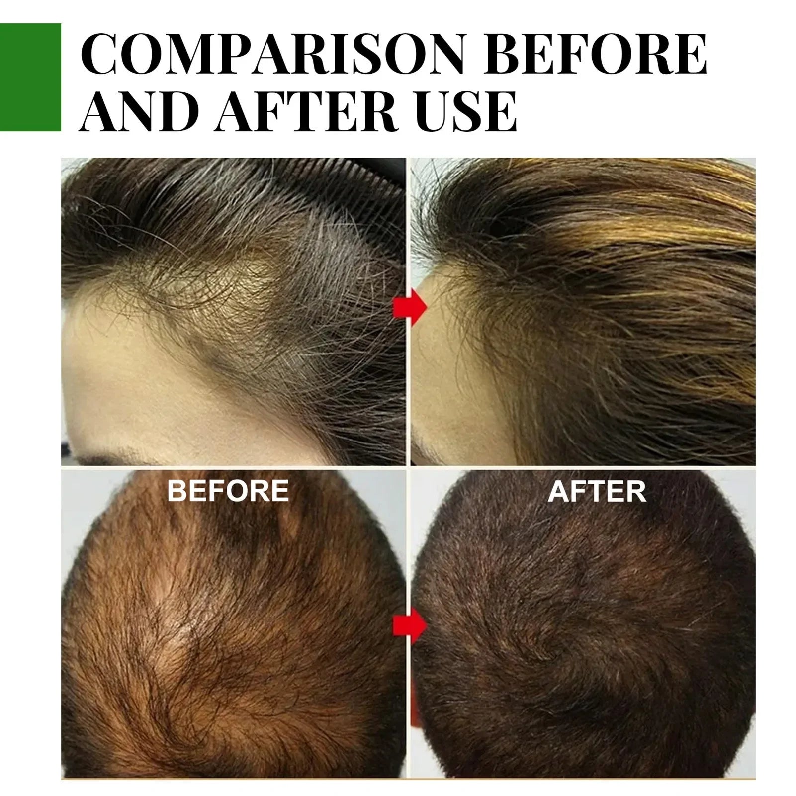 Rosemary Hair Growth Oil 30ML – Nourishing & Shiny Hair