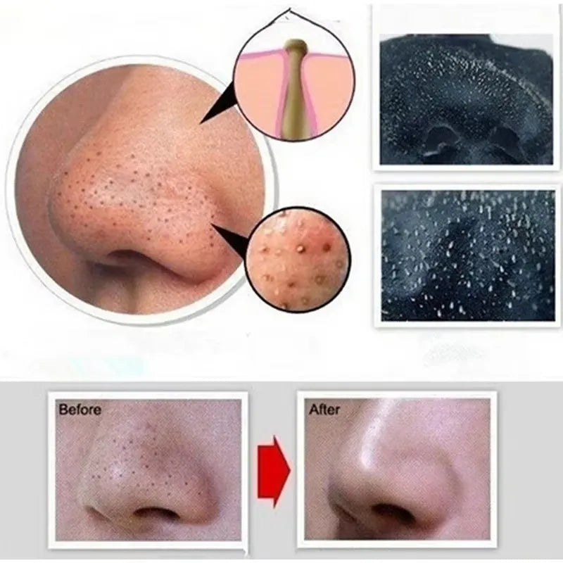 Bamboo Charcoal Blackhead Remover Mask – Peel-Off Pore Cleansing