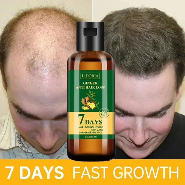 Ginger Hair Growth Serum – Anti-Hair Loss & Regrowth