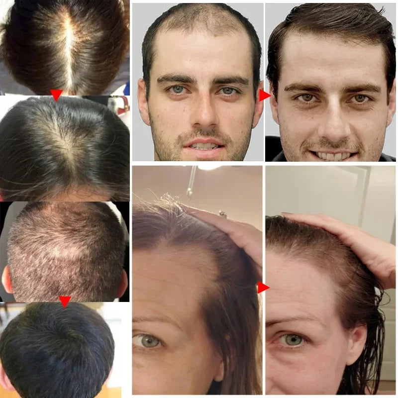 Ginger Hair Growth Serum – Anti-Hair Loss & Regrowth