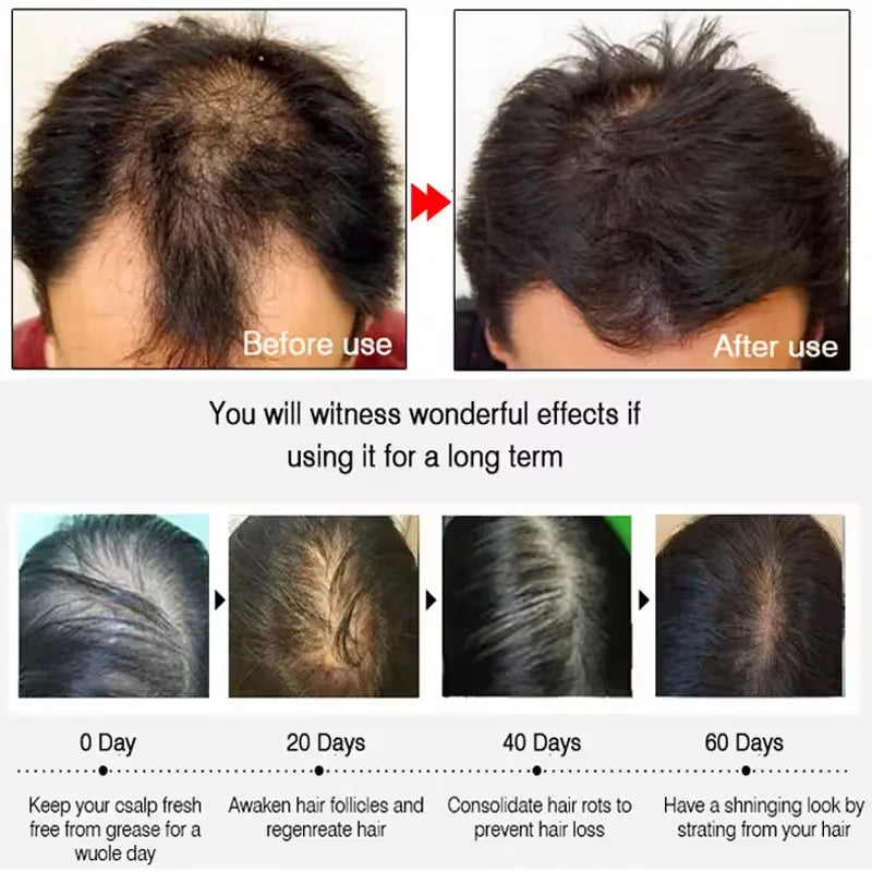 7-Day Batana Oil Hair Growth Serum – Anti-Hair Loss & Repair