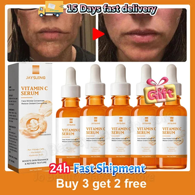 Vitamin C Whitening Serum – Dark Spot & Wrinkle Correcting Essence