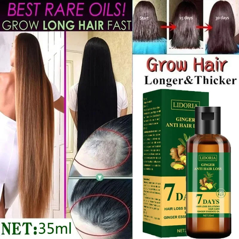 Ginger Hair Growth Serum – Anti-Hair Loss & Regrowth