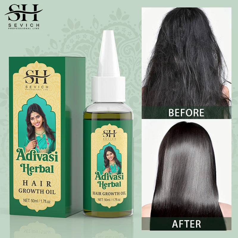 Ayurvedic Hair Growth Oil – Organic Hair Regrowth & Anti-Hair Loss