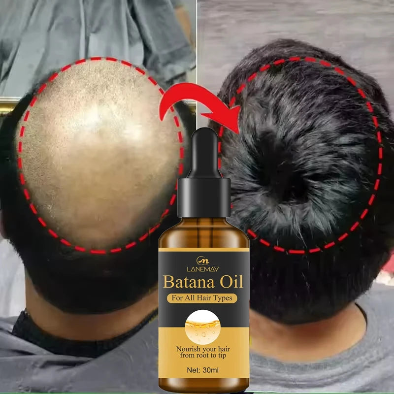 7-Day Batana Oil Hair Growth Serum – Anti-Hair Loss & Repair