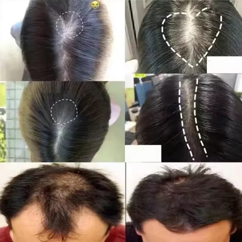 7-Day Batana Oil Hair Growth Serum – Anti-Hair Loss & Repair