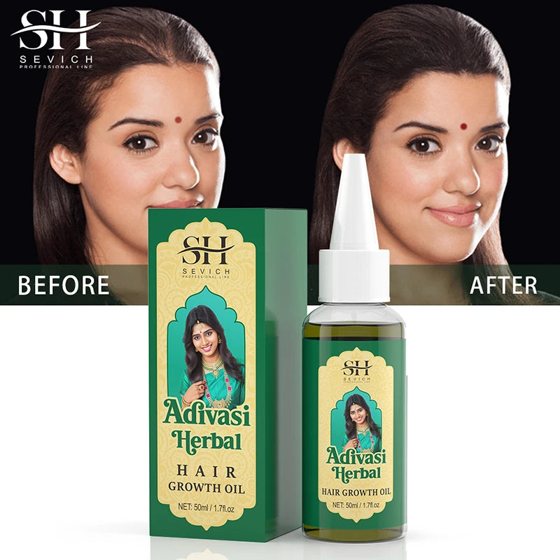 Ayurvedic Hair Growth Oil – Organic Hair Regrowth & Anti-Hair Loss