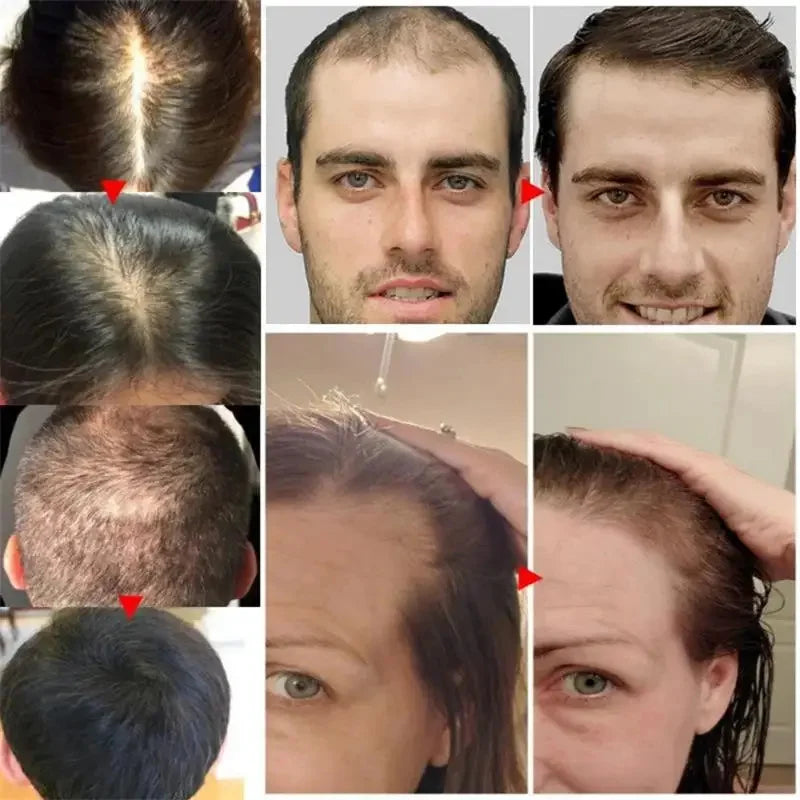 7-Day Batana Oil Hair Growth Serum – Anti-Hair Loss & Repair