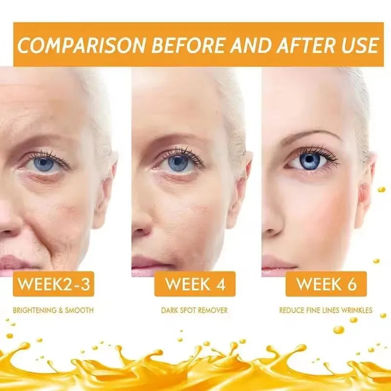 Vitamin C Whitening Serum – Dark Spot & Wrinkle Correcting Essence