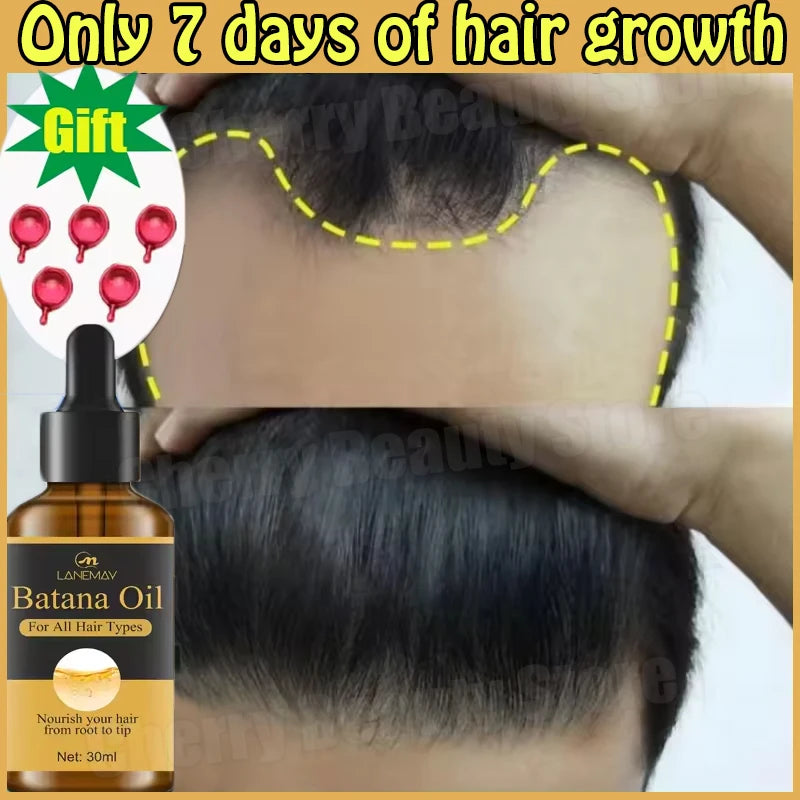 7-Day Batana Oil Hair Growth Serum – Anti-Hair Loss & Repair