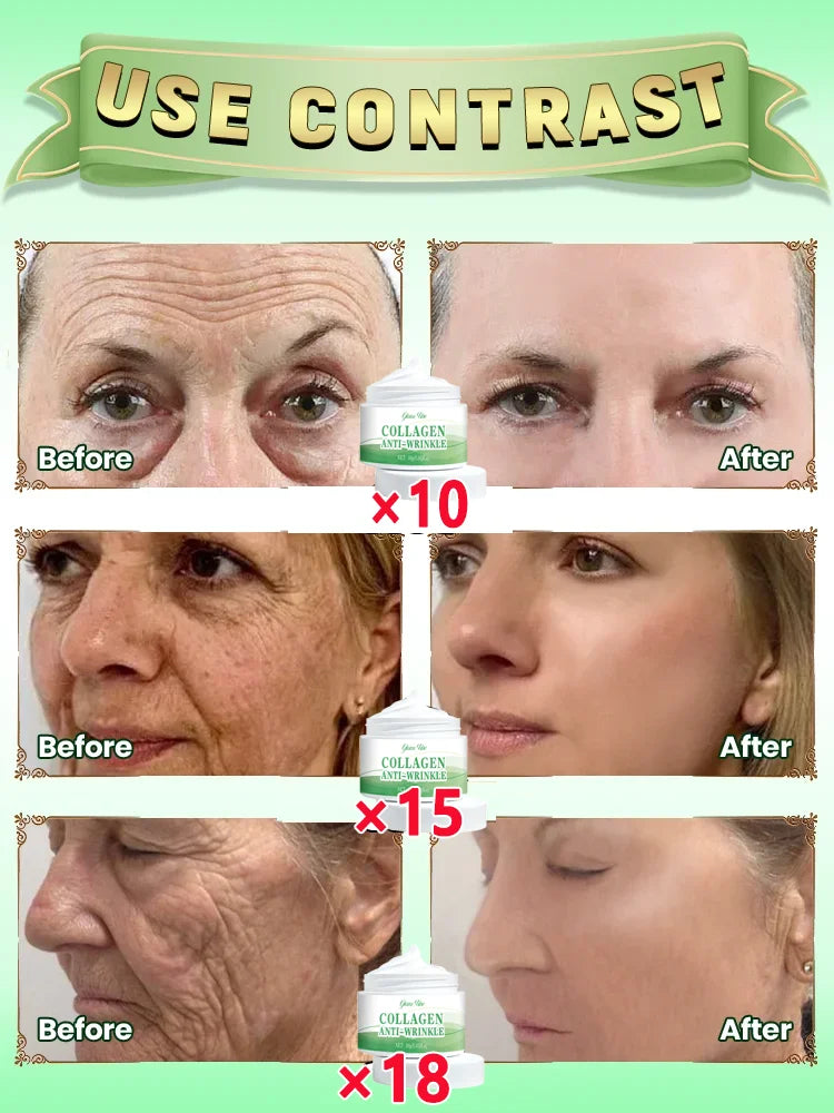 Anti-Aging Wrinkle-Removing Cream – Deep Moisturizing Face Care
