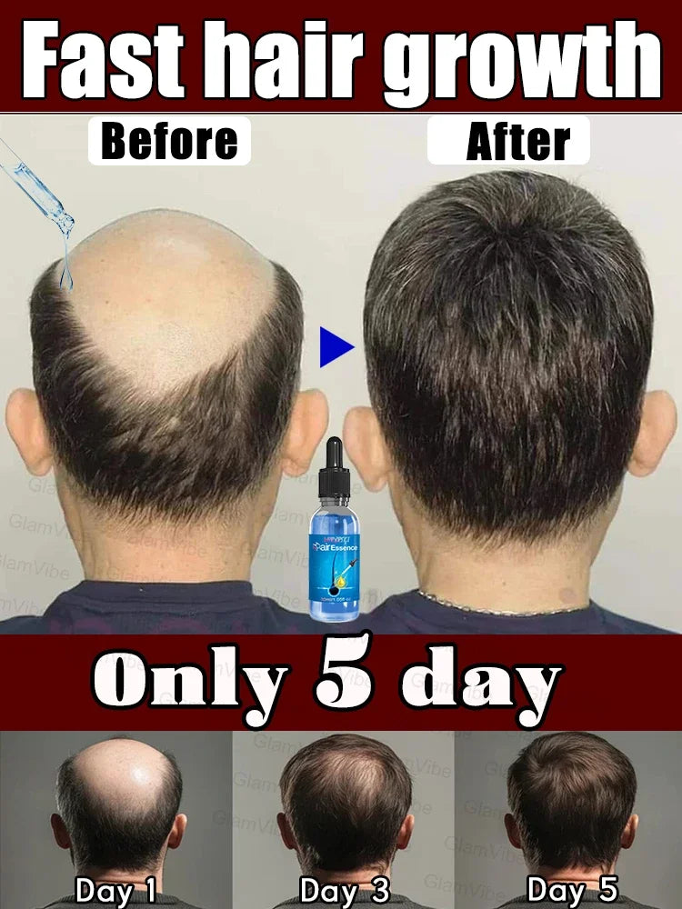 WPRBREGT Blue Hair Growth Essential Oil